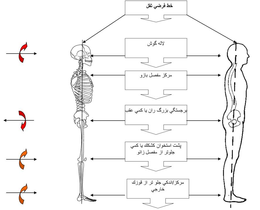 حرکات اصلاحی و ورزشی (تشخیص، راه های پیشگیری، تمرینات